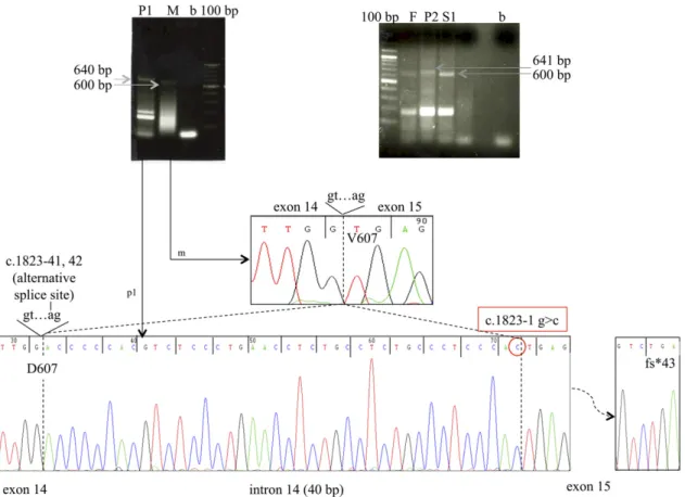 Figure 2. Complementary DNA amplification and sequencing from homozygous and heterozygous family members, demonstrating aberrant splicing of DUOX1