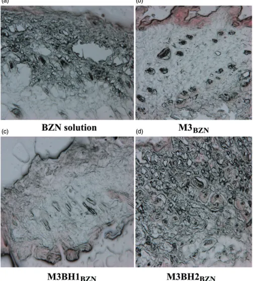 Figure 5. Microscopic images of treated rat skin with the (a) BZN solution, (b) M3 BZN microemulsion, (c) M3BH1 BZN and (d) M3BH2 BZN (magnification values 125x).