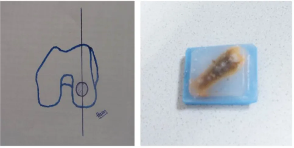Fig. 6. The distal femur sagittal samples obtained for the histopathological evaluation
