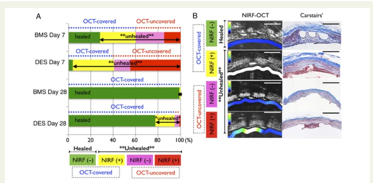 Figure 5 Fibrin molecular near-infrared fluorescence-optical coherence tomography imaging assessment of the healing status of edge stent