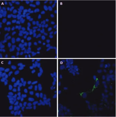 Figure 2. Immunocytochemical imaging. (a) shows the cell nuclei of the control sample  without Aβ, (b) exhibits the control sample without Aβ incubated with anti-Aβ antibody,   (c) shows the cell nuclei of the sample where 10 µM Aβ has been applied, (d) th