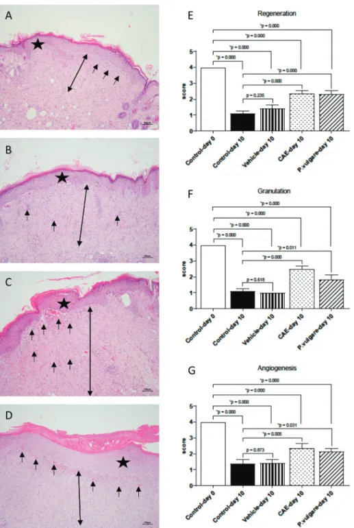 Figure 2. Histopathological view of injured tissues of the control (A), vehicle gel (B), CAE (C) and P.vulgare (D) extract gel  on 10th day after wound incision (Original magnification X10)