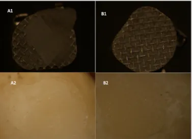 Figure 5. SEM view of the Clearfil sampleFigure 4. SEM view of the Transbond XT sample