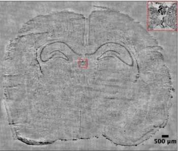 Figure 8. Automated stitching output of quantitative phase im- im-ages covering the entire mouse brain tissue section