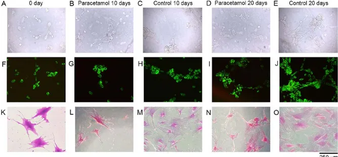 Figure 1. Microscopic evaluation of cultured cells. Lane 1, inverted microscopy of (A) 0 day, (B) 10 days of paracetamol application, (C) 10 day control,  (D) 20 days of paracetamol application and (E) 20 day control without staining