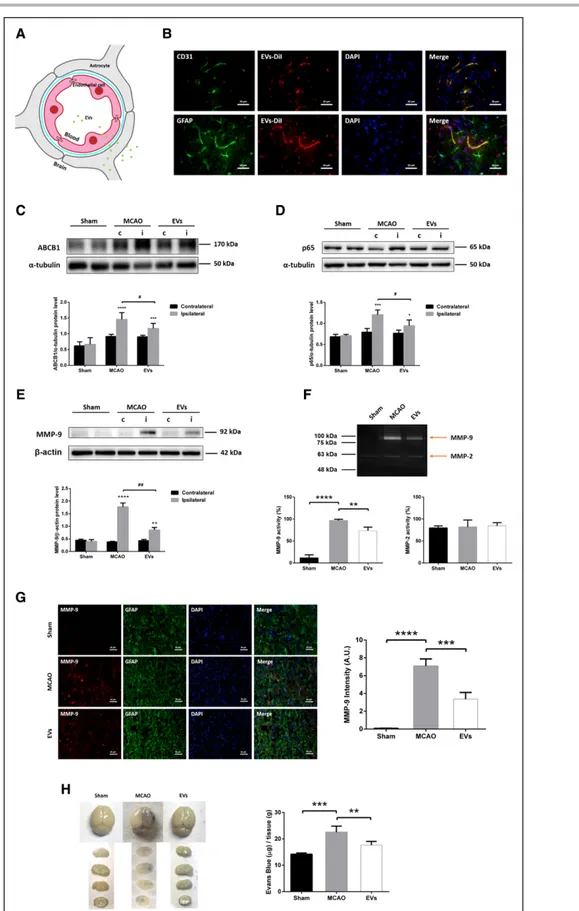 Figure 6. Extracellular vesicle (EV) administration mitigates middle cerebral artery occlusion (MCAO)-induced upregulation of  ABCB1 (ATP-binding cassette subfamily B member 1 transporter) and MMP-9 (matrix metalloproteinase 9) as well as activation  of NF