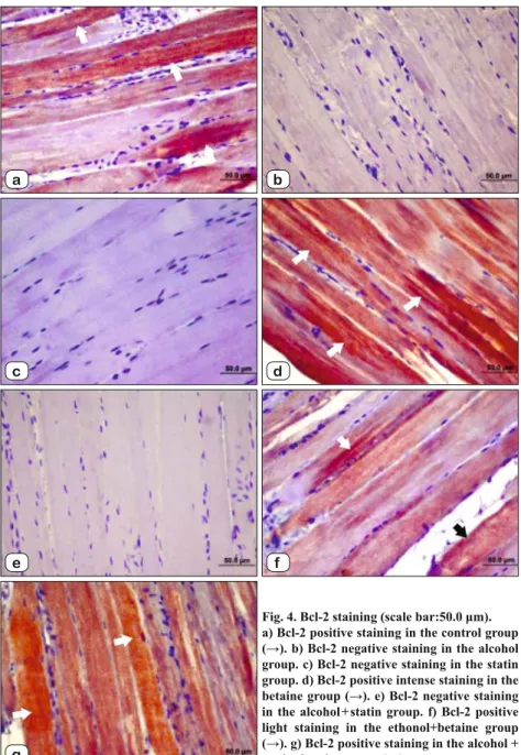 Fig. 4. Bcl-2 staining (scale bar:50.0 μm). 
