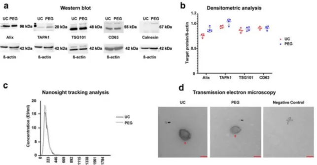 Fig. 1 Western blotting, nanosight tracking analysis (NTA), and transmission electron microscopy (TEM) of enriched NPC-EVs