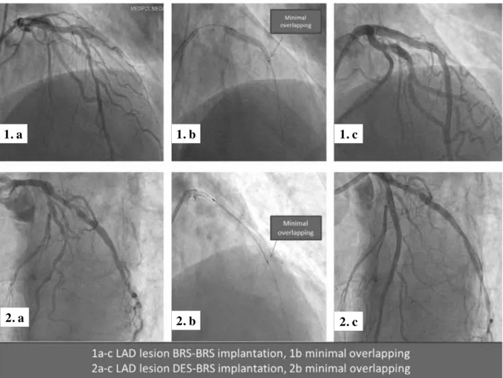 Figure 1. Angiographic images.