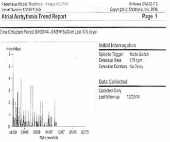 Figure 1. Atrial arrhythmia trend report.