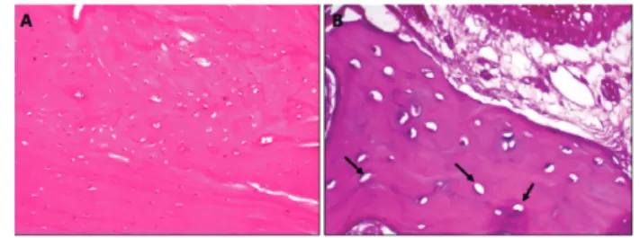 Figure 1 - (A) Appearance of bone from group 1 (simultaneous  zoledronate and relaxin) with no signs of necrosis on  histopathological examination