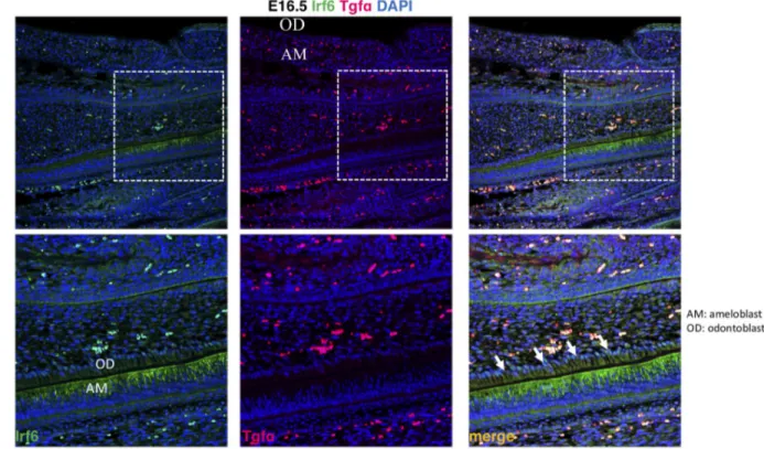 Fig 1. Expression of Irf6 and Tgfa in sagittal sections of E16.5 wild type murine embryos