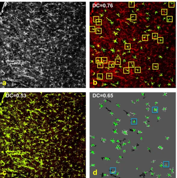 Table 2.  Astrocyte segmentation performance on a representative image from our dataset Set_1 (same as  Fig. 7) measured using Sensitivity (S), Precision (P) and Dice’s Coefficient (DC)
