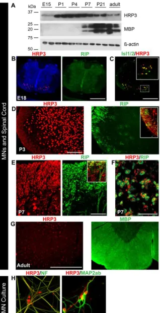 Figure  2.  HRP3  was  up-regulated  at  the  onset  of  myelination,  with  significant  neuronal  body  and  axonal expression in the developing MNs and white matter tract of spinal cord