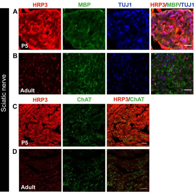 Figure 3. HRP3 expression in PNS nerve fibers is transiently upregulated during myelination period