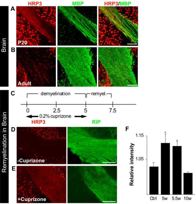 Figure 6. HRP3 expression in defined CNS white matter tracts consistently peaks with the period of  myelination and during remyelination
