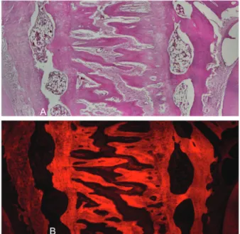 Figure 6.  (A) Photomicrograph of a section in the expansion area  of Group C showing abundant formation of bone trabeculae