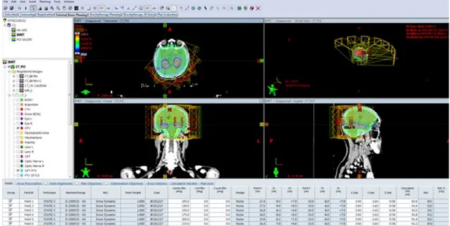 Fig. 2 Typical isodose distribution of IMRT plans