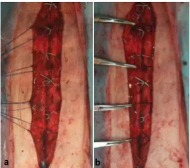 Figure 3. Maxon suture reinforcement. A, Maxon sutures placement; 