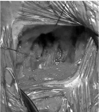 Figure 5. Cannulation sutures tied after decannulation.
