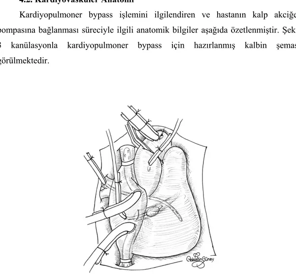 Şekil 3: Kanülasyonla kardiyopulmoner bypass için hazırlanmış kalbin şematik görünümü  (15) 