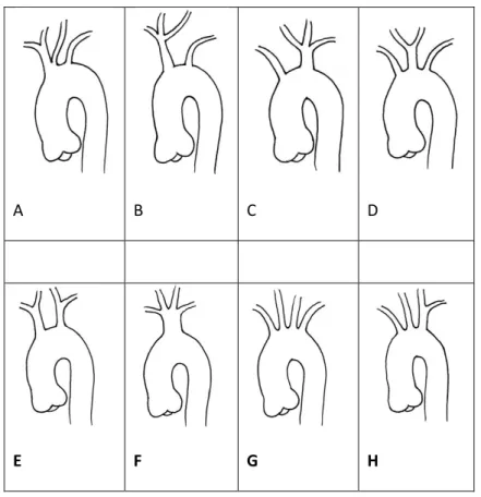 Şekil 4: Arkus aorta dallarının orijin varyasyonları (15). 