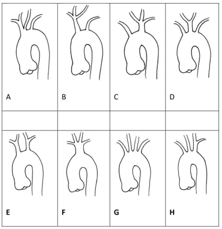 Şekil 4: Arkus aorta dallarının orijin varyasyonları (15). 