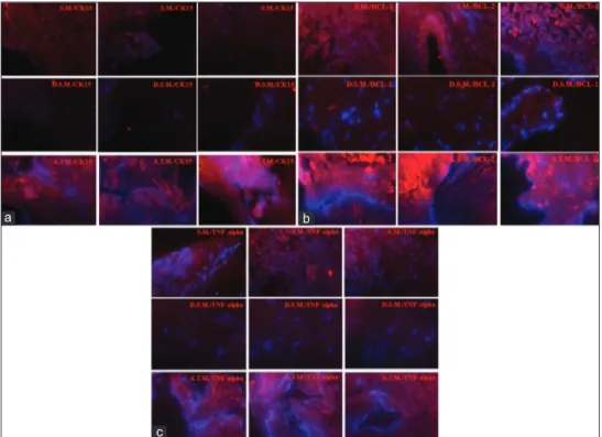 Figure 4: Fluorescent immunohistochemistry for untreated nasal S.M., D. S. M, and A.T.M