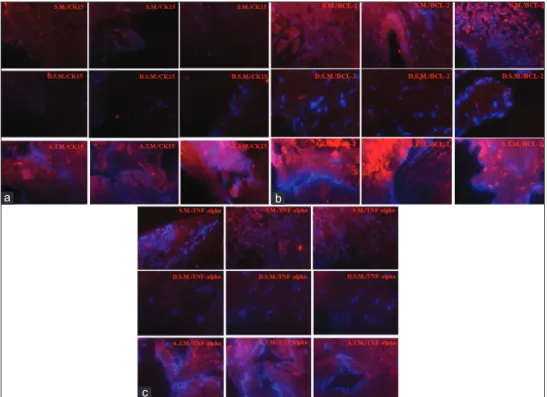 Figure 4: Fluorescent immunohistochemistry for untreated nasal S.M., D. S. M, and A.T.M