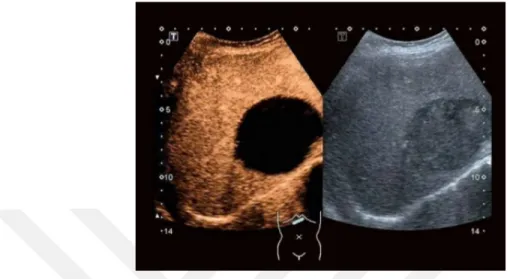 Figure 2.1: A comparison of an US image before and after the addition of the contrast agents.