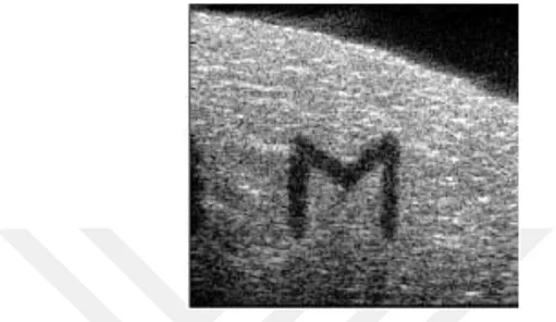Figure 2.5: The letter ’M’ drawn on a tissue phantom using histotripsy.