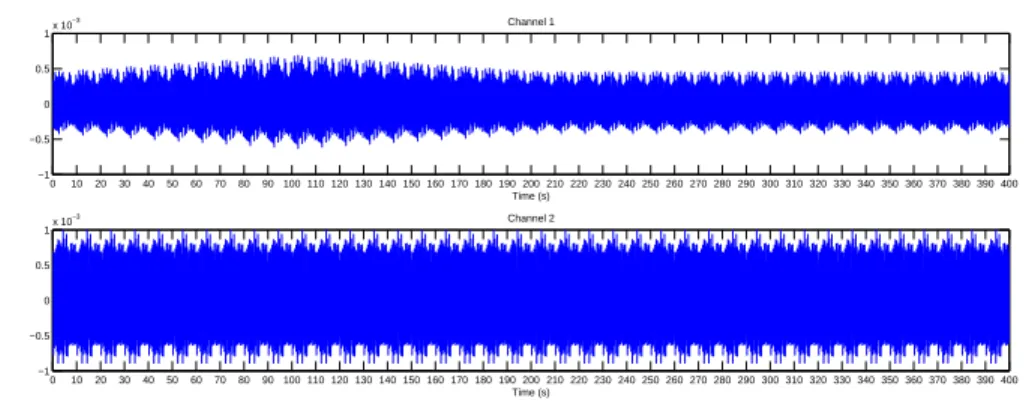 Figure 2.9: Distorted wrist flexion movement signal which is arranged by DT2 Distortion type 3 (DT3): Undistorted 10 seconds signals are appended at