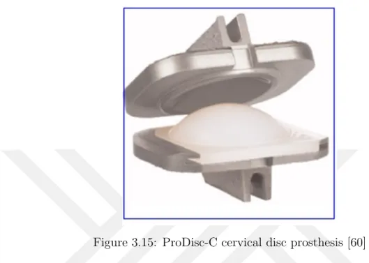 Figure 3.15: ProDisc-C cervical disc prosthesis [60]