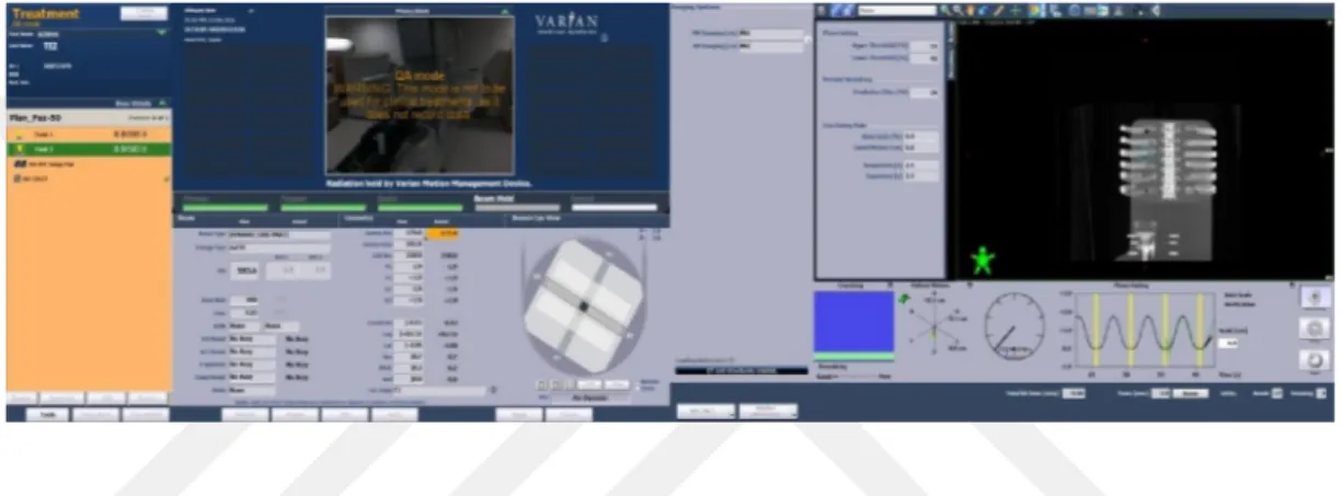 Şekil  5.2.10.2.  Truebeam  STx  cihazı  için  örnek  bir  ışınlamada  konsoldan  alınan  ekran  görüntüsü