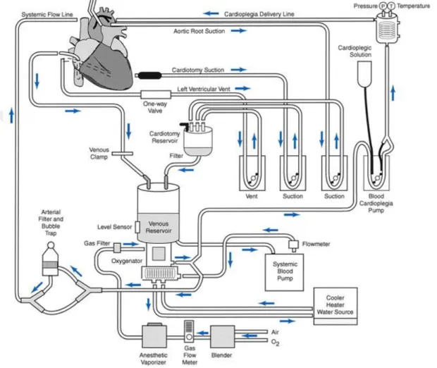 Şekil 4.1.1: Kardiyopulmoner Bypass Devresi 