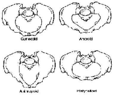 Şekil 4.2.1.1. Maternal pelvis tipi                  Şekil 4.2.1.2. Maternal pelvis çapları  Doğum objesi fetüstür