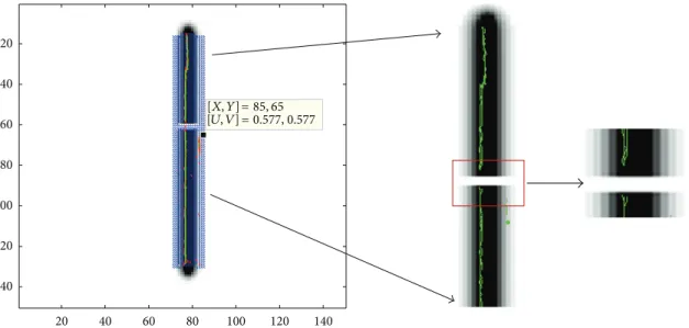 Figure 4: Linear break trajectory. Eigenvectors representing the diffusivity are superimposed on T2 image in blue
