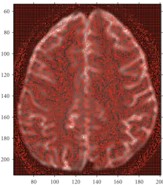 Figure 3: Calculated principal eigenvectors of the entire slice super- super-imposed on axial brain MR image.