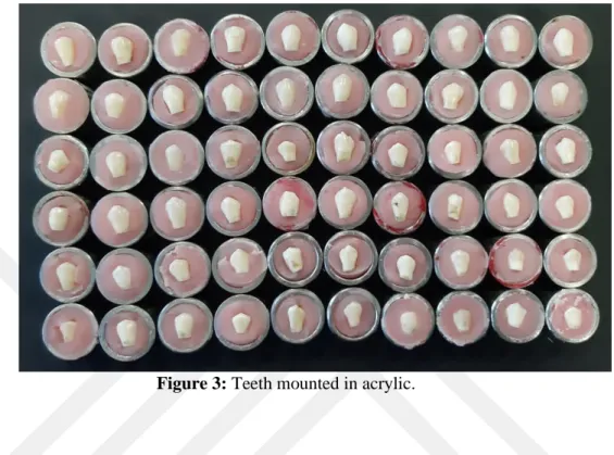 Figure 3: Teeth mounted in acrylic. 