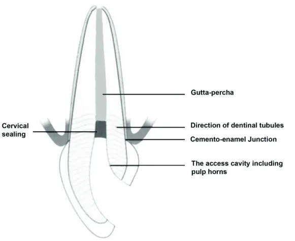 Figure 5. Proximal view of a nonvital anterior teeth