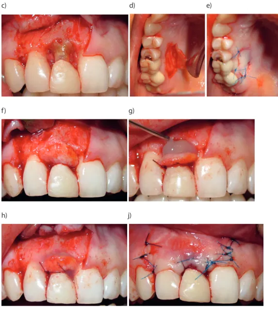 Figure 3. 12 months postoperative clinical view 