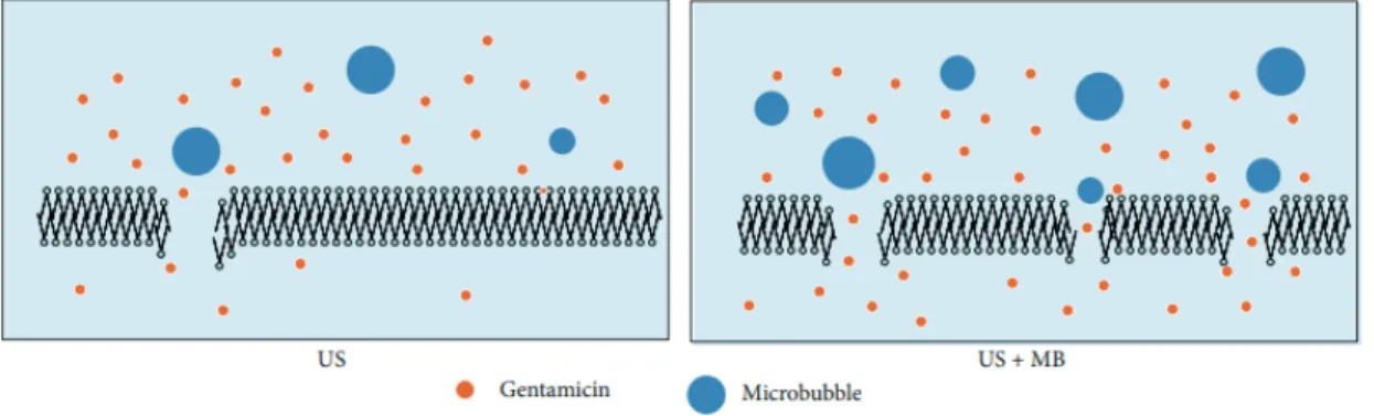 Figure 2. Increasing the treatment efficacy by adding micro bubble (Zhu, 2014).