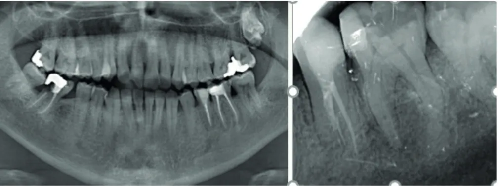Figure 3. After 1-year follow-up radiograps
