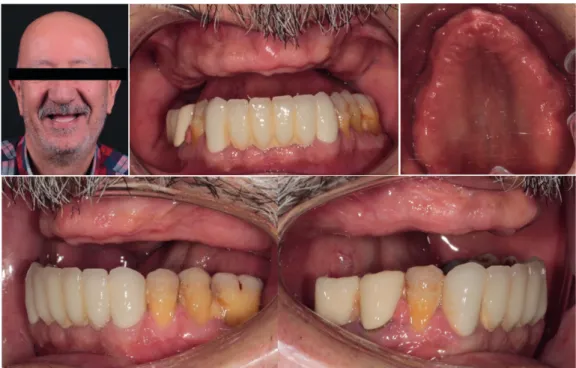 Figure 1. Frontal and intraoral views of the patient