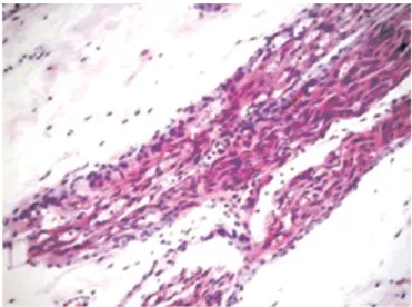 Fig. 7. Edema in nimodipine group (×200 HE).