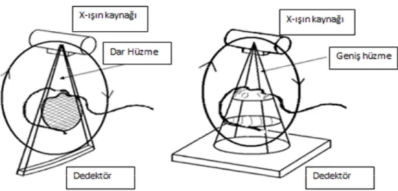 Şekil 2.12 a) Bilgisayarlı tomografi’de dar hüzme,  b) Konik hüzmeli bilgisayarlı  tomografide geniş hüzme 