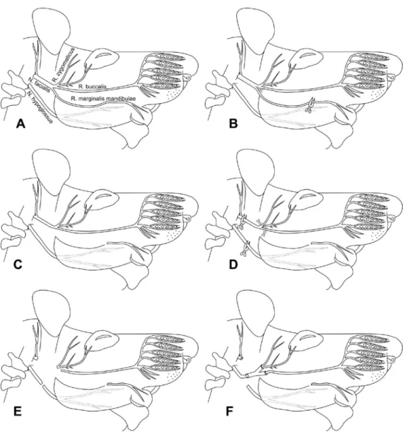 Şekil 3.5. Aorta Y tüpü ile yapılan hypoglossal-fasiyal anastomoz’un şematik gösterimi