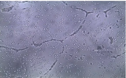 Şekil 2.3. Verticillium fungicola’ nın 40x mikroskoptaki konidilerin görüntüsü 