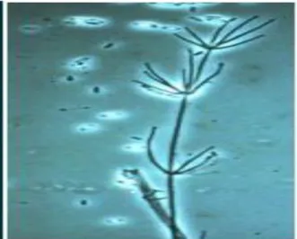 Şekil  2.4.  Verticillium  fungicola  konidiaforlarının  40x  büyütmeli  mikroskoptaki  görüntüsü 