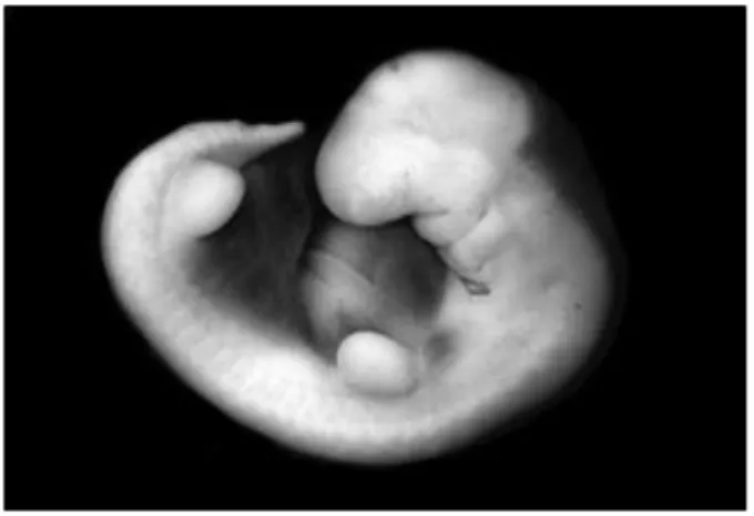 Şekil  2.2.      Embriyo  gelişiminin  4.  haftasında  ventrolateral  vücut  duvarında  kabartılar  şeklinde    belirginleşen  ekstremite  tomurcukları  görülmektedir [8].